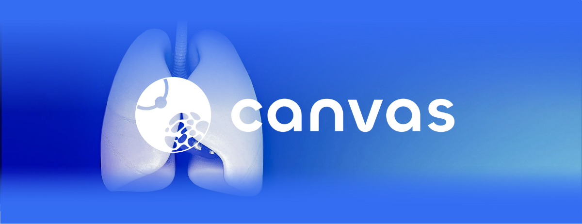 canvas project 2